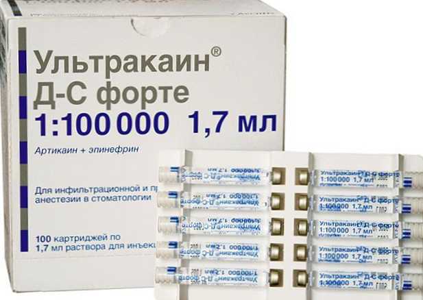 Ультракаин 1 200000 Купить В Ростове